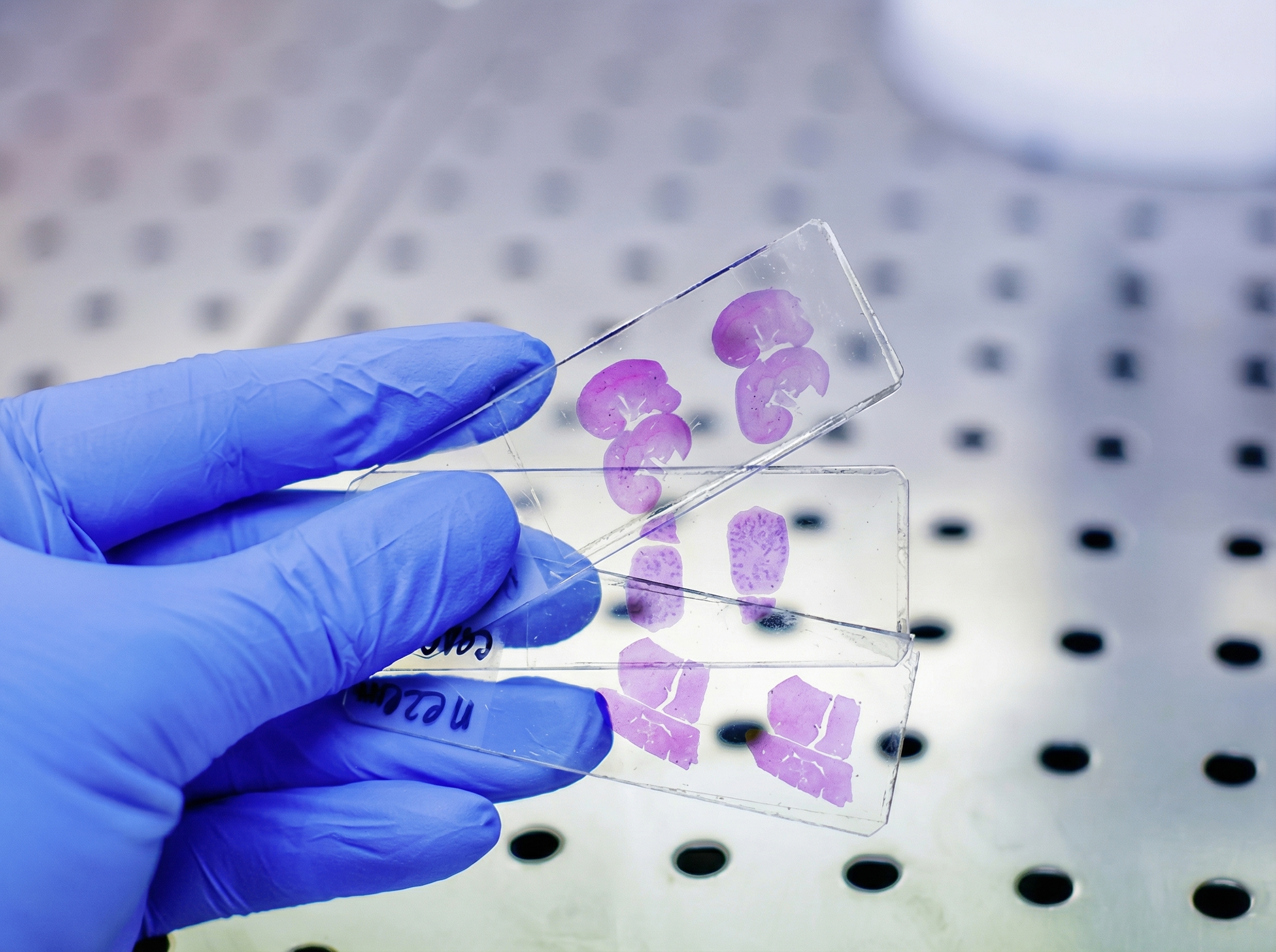 Precision Development